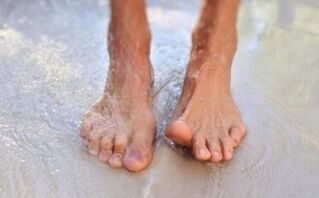 Gombák a lábujjak között Photo viszont tünetek, okok, kezelés, megelőzés