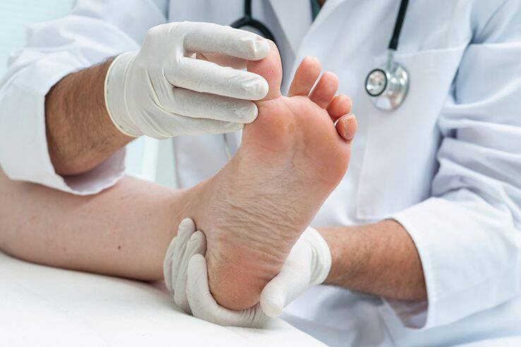 Dermatológus megvizsgálja a beteg lábát